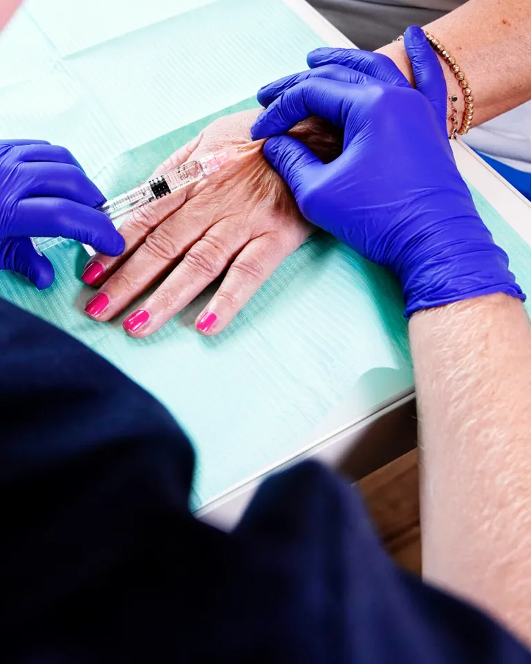Le mani guantate di viola e la siringa sul dorso di una mano, per ringiovanirne la pelle